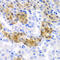 4-Hydroxyphenylpyruvate Dioxygenase antibody, 22-273, ProSci, Immunohistochemistry paraffin image 