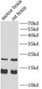 Myelin Basic Protein antibody, FNab05465, FineTest, Western Blot image 
