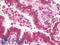 Mitochondrial Ribosomal Protein L13 antibody, LS-B9682, Lifespan Biosciences, Immunohistochemistry paraffin image 