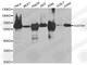 Sequestosome 1 antibody, A0682, ABclonal Technology, Western Blot image 