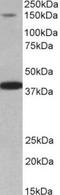 Insulin receptor substrate 4 antibody, TA311395, Origene, Western Blot image 