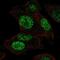 Phosphoglycerate mutase 1 antibody, NBP2-56569, Novus Biologicals, Immunocytochemistry image 