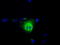 Thromboxane A Synthase 1 antibody, TA501365, Origene, Immunofluorescence image 