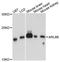 ADP Ribosylation Factor Like GTPase 8B antibody, A8869, ABclonal Technology, Western Blot image 