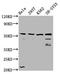 RUN And FYVE Domain Containing 3 antibody, LS-C681236, Lifespan Biosciences, Western Blot image 