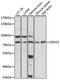 DEAD-Box Helicase 51 antibody, GTX66402, GeneTex, Western Blot image 