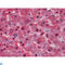 Lipoprotein(A) antibody, LS-C812390, Lifespan Biosciences, Immunohistochemistry paraffin image 