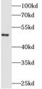 Fibrinogen Beta Chain antibody, FNab03084, FineTest, Western Blot image 