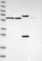 Sperm Acrosome Associated 9 antibody, NBP1-90933, Novus Biologicals, Western Blot image 