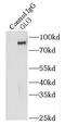 GLI Family Zinc Finger 3 antibody, FNab03478, FineTest, Immunoprecipitation image 