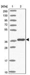 T-Box 10 antibody, PA5-61615, Invitrogen Antibodies, Western Blot image 