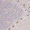 Host cell factor C1 regulator 1 antibody, NBP2-31788, Novus Biologicals, Immunohistochemistry paraffin image 