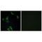 Cell Death Inducing DFFA Like Effector B antibody, A07404, Boster Biological Technology, Immunohistochemistry paraffin image 