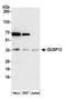 Dual specificity protein phosphatase 12 antibody, A305-588A-M, Bethyl Labs, Western Blot image 