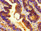 Histone Cluster 1 H1 Family Member E antibody, LS-C670371, Lifespan Biosciences, Immunohistochemistry paraffin image 
