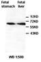 Zinc Finger Protein 668 antibody, orb77190, Biorbyt, Western Blot image 