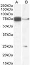 Delta Like Canonical Notch Ligand 1 antibody, LS-C112754, Lifespan Biosciences, Western Blot image 