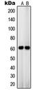 Solute Carrier Family 22 Member 3 antibody, LS-C352857, Lifespan Biosciences, Western Blot image 