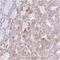C2 Calcium Dependent Domain Containing 4C antibody, NBP2-30575, Novus Biologicals, Immunohistochemistry frozen image 
