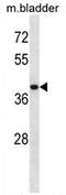Ubiquitin Specific Peptidase 12 antibody, AP54486PU-N, Origene, Western Blot image 