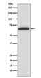 Hnf-1b antibody, M01270, Boster Biological Technology, Western Blot image 