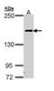 Complement C5 antibody, PA5-22183, Invitrogen Antibodies, Western Blot image 