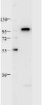 Signal Transducer And Activator Of Transcription 2 antibody, orb344465, Biorbyt, Western Blot image 