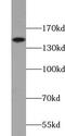 Uveal Autoantigen With Coiled-Coil Domains And Ankyrin Repeats antibody, FNab09140, FineTest, Western Blot image 