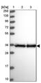 Eukaryotic Translation Elongation Factor 1 Delta antibody, PA5-60923, Invitrogen Antibodies, Western Blot image 