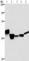 Major facilitator superfamily domain-containing protein 2A antibody, TA351394, Origene, Western Blot image 