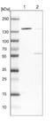 Dipeptidyl Peptidase 7 antibody, NBP1-84986, Novus Biologicals, Western Blot image 
