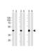 STEAP2 Metalloreductase antibody, LS-C161555, Lifespan Biosciences, Western Blot image 