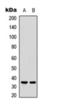 Caspase 3 antibody, orb393232, Biorbyt, Western Blot image 