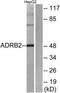 ADRB2 antibody, TA313384, Origene, Western Blot image 