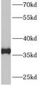 PAP-III antibody, FNab00433, FineTest, Western Blot image 