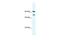 Zinc Finger E-Box Binding Homeobox 2 antibody, PA5-40758, Invitrogen Antibodies, Western Blot image 