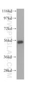 Histone Deacetylase 2 antibody, 16152-1-AP, Proteintech Group, Western Blot image 