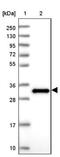 EF-Hand Domain Family Member D2 antibody, NBP2-13947, Novus Biologicals, Western Blot image 