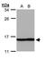Profilin 2 antibody, GTX108589, GeneTex, Western Blot image 