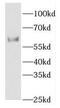 ETS Variant 4 antibody, FNab02880, FineTest, Western Blot image 
