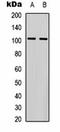 Glutamate receptor 4 antibody, orb334650, Biorbyt, Western Blot image 