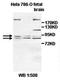 Cytosolic carboxypeptidase-like protein 5 antibody, orb77804, Biorbyt, Western Blot image 