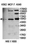 Katanin Catalytic Subunit A1 Like 1 antibody, orb78208, Biorbyt, Western Blot image 