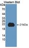 Integrin beta-8 antibody, LS-C374320, Lifespan Biosciences, Western Blot image 