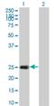 Heat Shock Protein Family B (Small) Member 8 antibody, H00026353-M02, Novus Biologicals, Western Blot image 