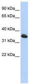 LIM Homeobox 3 antibody, TA330542, Origene, Western Blot image 