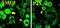 Amiloride-sensitive cation channel 3 antibody, A02816-1, Boster Biological Technology, Immunohistochemistry paraffin image 