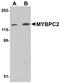 Myosin Binding Protein C, Fast Type antibody, PA5-20917, Invitrogen Antibodies, Western Blot image 
