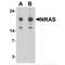 Ras antibody, MBS153718, MyBioSource, Western Blot image 