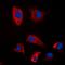 Proteasome 26S Subunit, Non-ATPase 2 antibody, orb214467, Biorbyt, Immunofluorescence image 